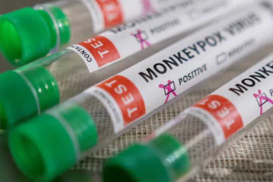 Monkeypox: ਭਾਰਤ 'ਚ ਕੇਰਲਾ ਦੇ ਕਨੂੰਰ 'ਚ ਦਰਜ ਹੋਇਆ ਮੰਕੀਪਾਕਸ ਦਾ ਦੂਜਾ ਕੇਸ